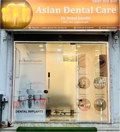 asian dental care borivali west 